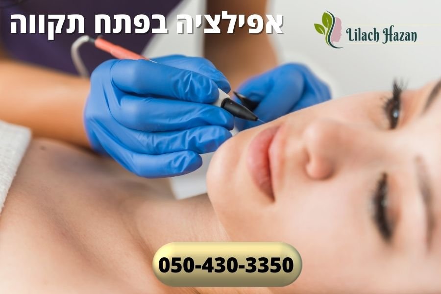 אפילציה בפתח תקווה