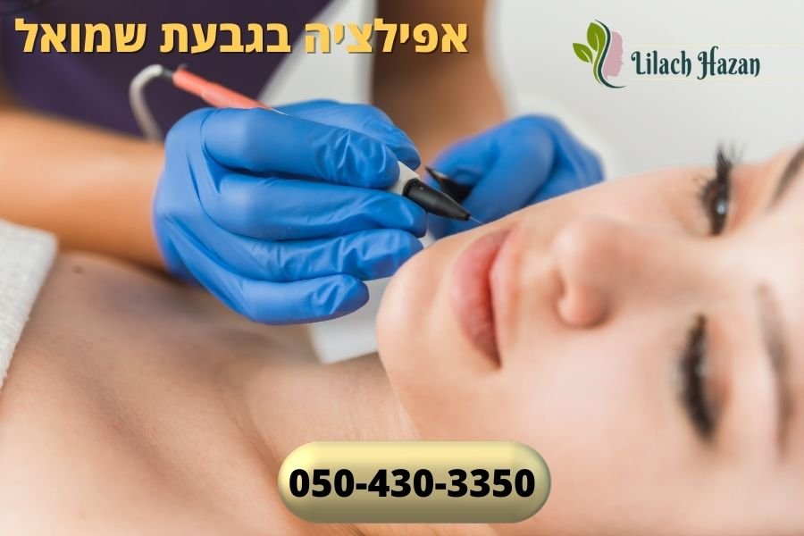 אפילציה בגבעת שמואל